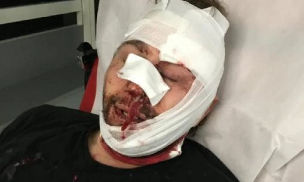 Θύμα άγριου ξυλοδαρμού από τα γαλλικά ΜΑΤ έπεσε Σύριος φωτορεπόρτερ του AFP